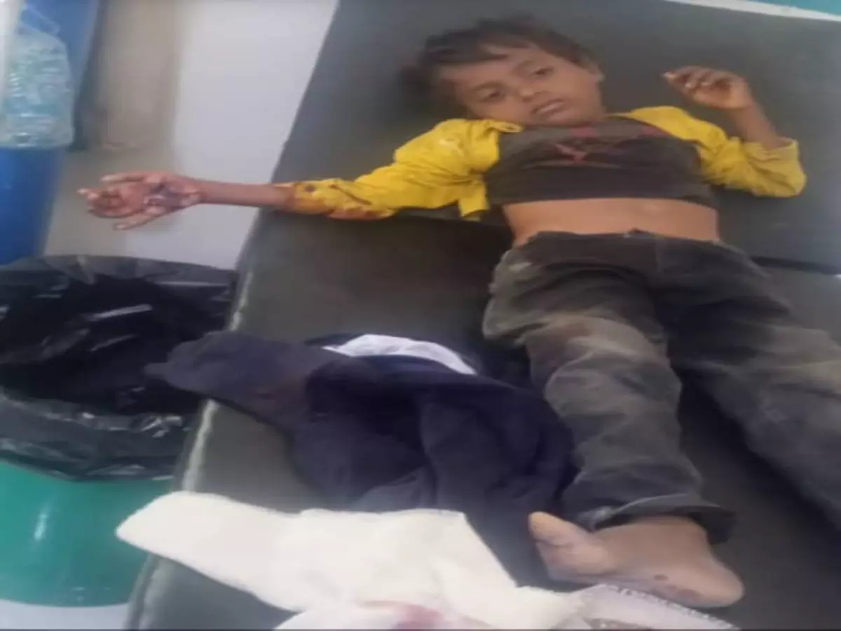 صادم في تعز: طفل 8 سنوات يلعب بصاعق ظنه لعبة... النتيجة مأساوية!