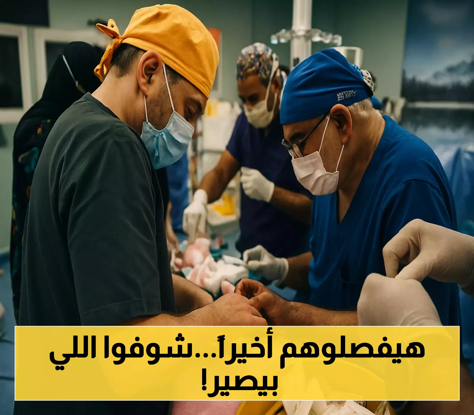 حصري: اقتراب الإنجاز في فصل السيامي السوري "سيلين وإيلين"