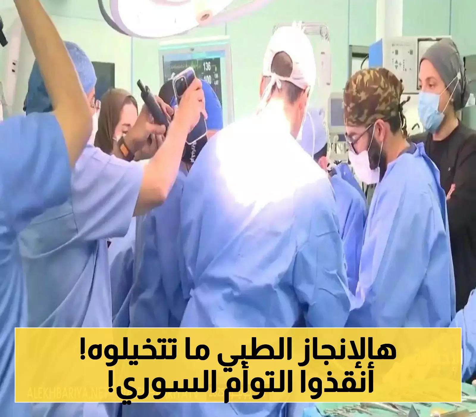 في 8 ساعات فقط.. السعودية تفصل التوأم السيامي السوري ضمن رحلة 35 عاماً أنقذت 66 توأماً من 27 دولة