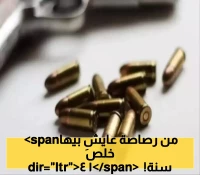 مثل المعجزة..بعد 14 سنة من العذاب استخراج رصاصة من جمجمة مواطن يمني!