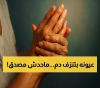 حالة مرضية نادرة تحير الأطباء: يمني يبكي دماً من عينيه بدل الدموع وتغطي جسده تقرحات تشبه "انفجارات البراكين" !