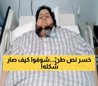 معجزة طبية: سعودي ينتقل من 610 إلى 63 كيلو ويصبح حديث العالم - الهند تبث قصته المذهلة!
