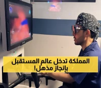 عاجل: الأحساء تحقق المعجزة الطبية - أول جراحة روبوتية لاستئصال ورم كلوي في تاريخ المملكة!