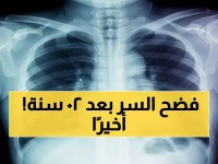 إنتبة: طبيب يمني يحل لغز مرض كامن لـ20 عاماً - فحوصات سلبية لكن المرض موجود!