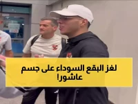 شاهد: علامات الحجامة الغريبة على إمام عاشور تثير الجدل... هل تخفي سراً طبياً قبل معركة الترجي؟