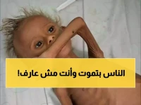 عاجل: 18 مليون يمني على حافة الموت جوعاً... والعالم يتجاهل مأساة القرن!