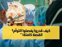 إنجاز طبي تاريخي: نجاح فصل توأم سعودي ملتصق مع نسبة خطورة 40% في عملية حافلة بالدراما