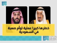 عاجل: السعودية تبدأ عملية فصل التوأم الملتصق الفلبيني في الرياض… خطر 50% ومضاعفات عصبية قد تصل 60% في العملية رقم 70 ضمن البرنامج الإنساني العالمي